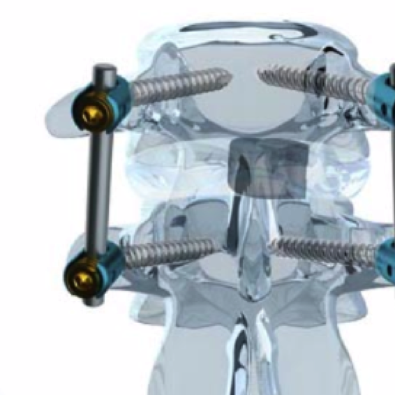 ISO 13485 in Medical Device Manufacturing